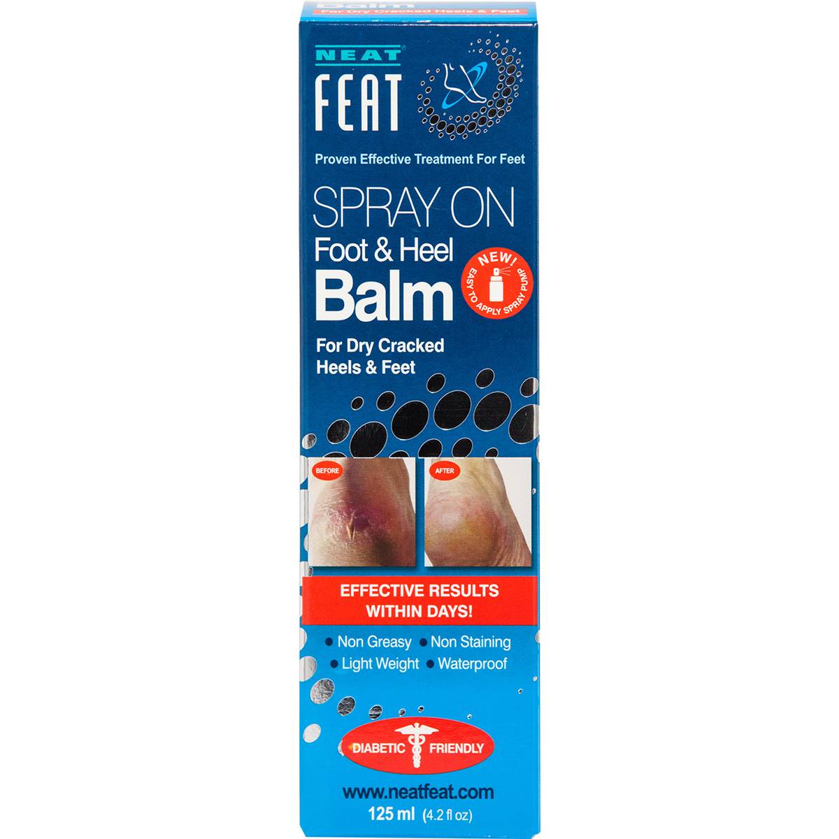 Neat Feat Spray On Foot & Heel Balm 125ml Woolworths